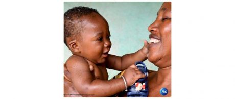 P&G Türkiye Yetkilisi Onur Yaprak ile Yenidoğan Tetanosu Üzerine