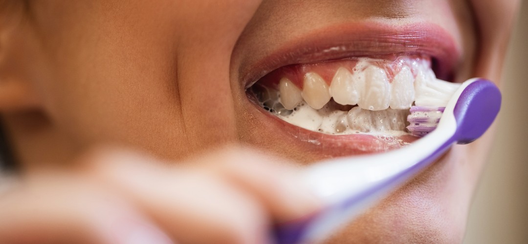 tuzla diş beyazlatma